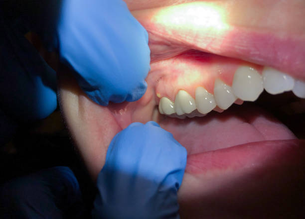 Best Emergency Dentist for Knocked-Out Tooth in Delta Junction, AK